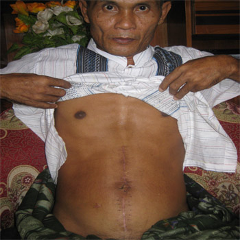 penusukan